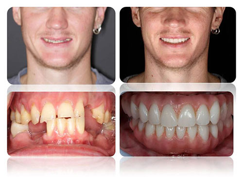 Oral and Maxillofacial Surgery - Kailas Dental Clinic & Implant Center