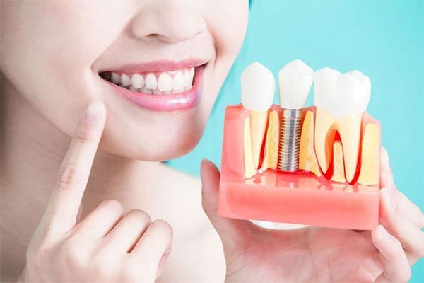 New Standard in Dental Implants - Kailas Medical Centre