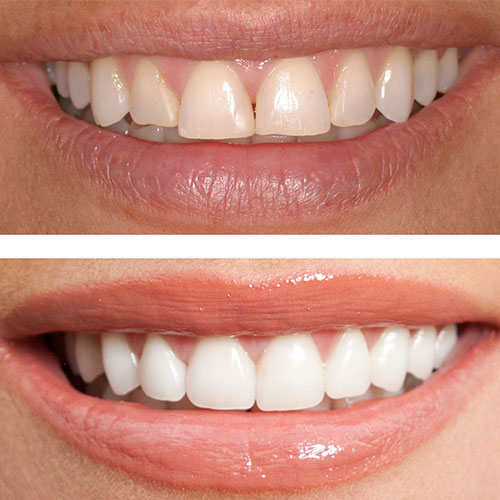 Cosmetic Dentistry